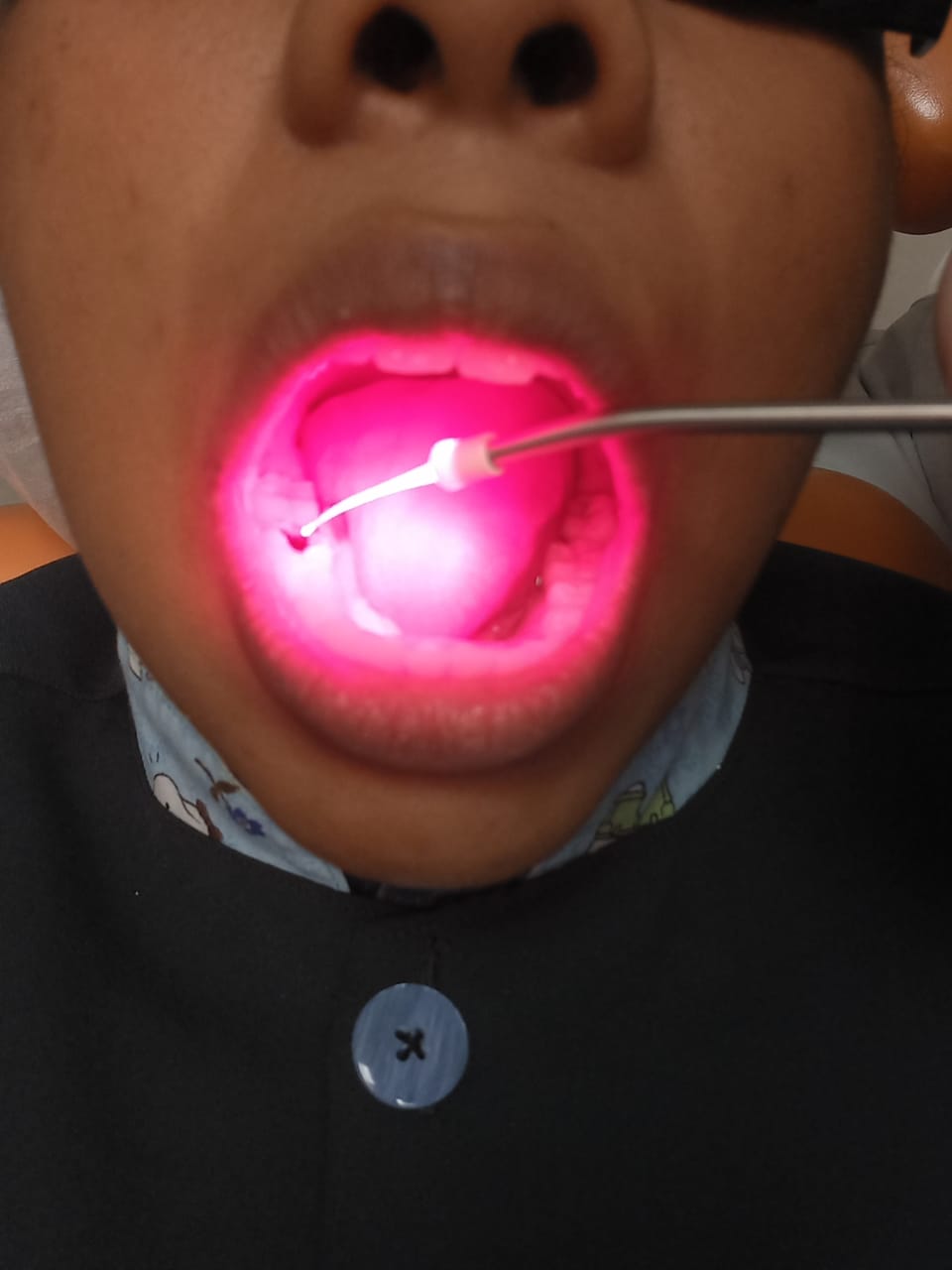 Imagem da terapia Fotodinâmica